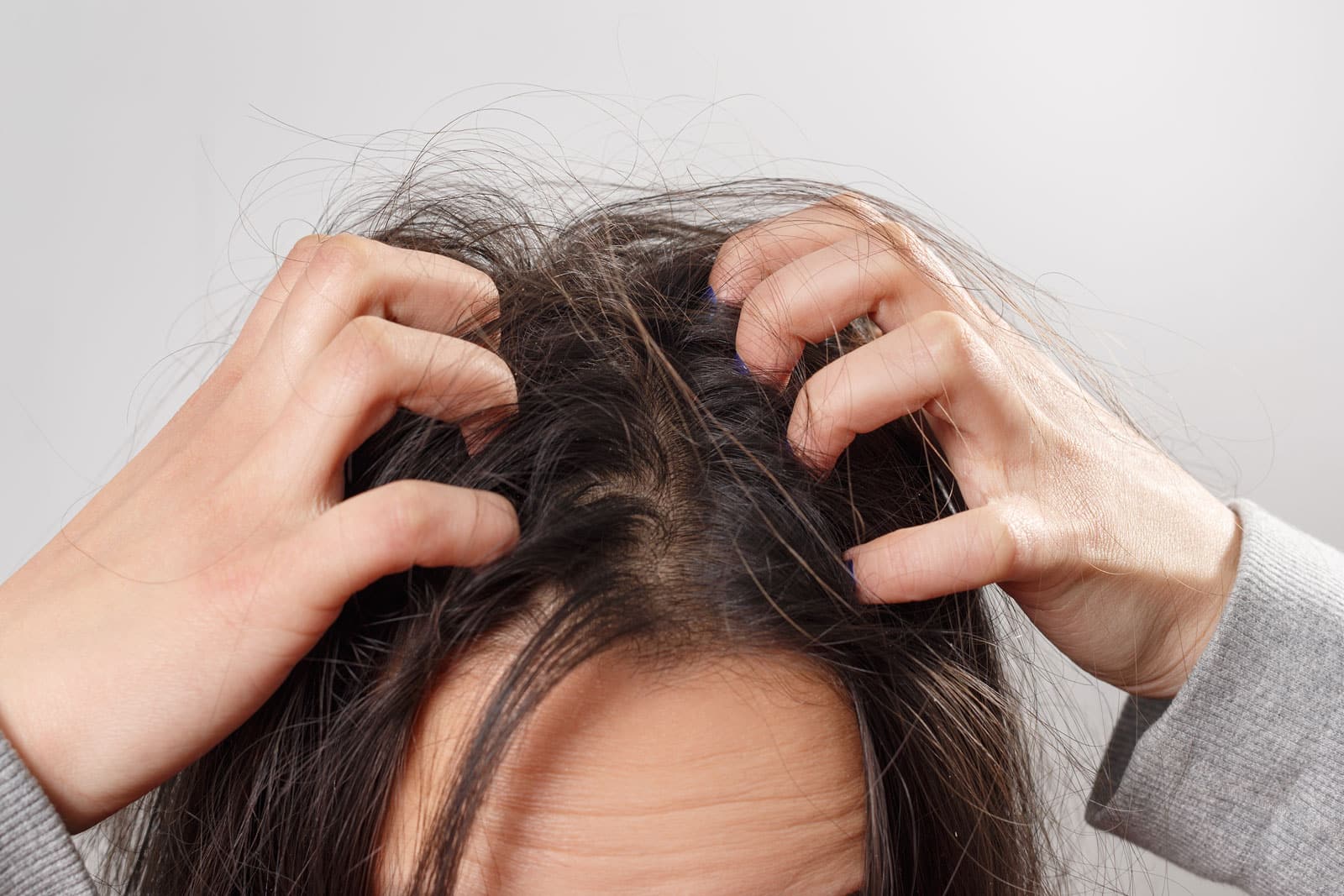 Understanding Sensitive Scalp: Causes, Treatments, and Care Tips